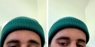 Partiellement paralysé du visage, Justin Bieber révèle son diagnostic inquiétant
