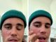 Partiellement paralysé du visage, Justin Bieber révèle son diagnostic inquiétant