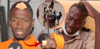 (Vidéo) – Sauvagement agress3, Mbaye Kouthia confie : « Dagn ma door brique… »